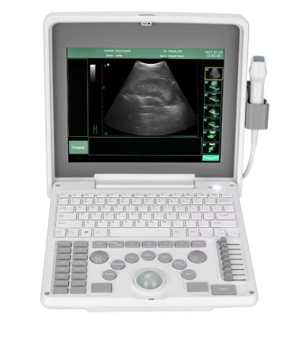 Medical Ultrasound Instrument 3d 4d 5d Ultrasound Scanner Sonoscape Portable Ultrasound Machine