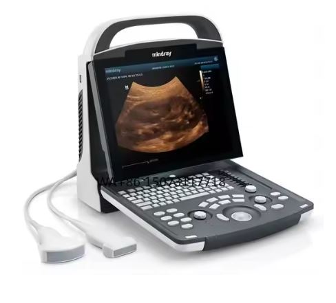 Portable Medical Ultrasound Instruments Human Use Mindray DP10 Black and White Ultrasound Machine Price Veterinary Scanner
