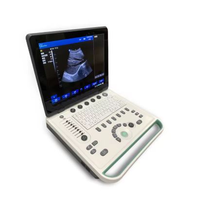 Color Doppler USG Portable Ultrasound Scanner 15-Inch Laptop Machine, Linear/Convex Probe, Clinical Diagnostic Use