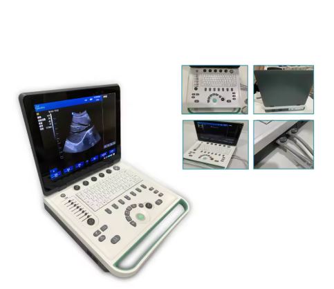 Color Doppler USG Portable Ultrasound Scanner 15-Inch Laptop Machine, Linear/Convex Probe, Clinical Diagnostic Use