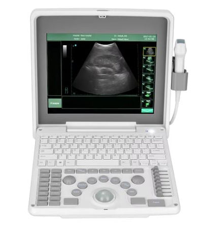 Medical Ultrasound Instrument 3d 4d 5d Ultrasound Scanner Sonoscape Portable Ultrasound Machine